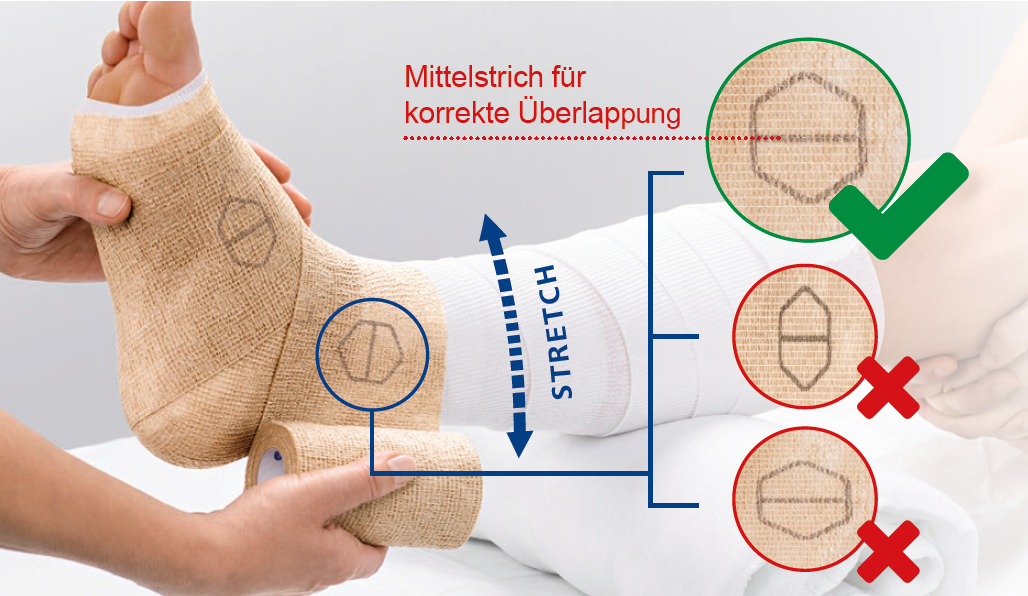 Wirkungsvolle Kompression mit PütterPro 2